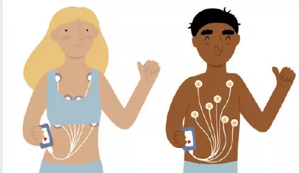 Acercamiento Al Estudio Holter Cardíaco