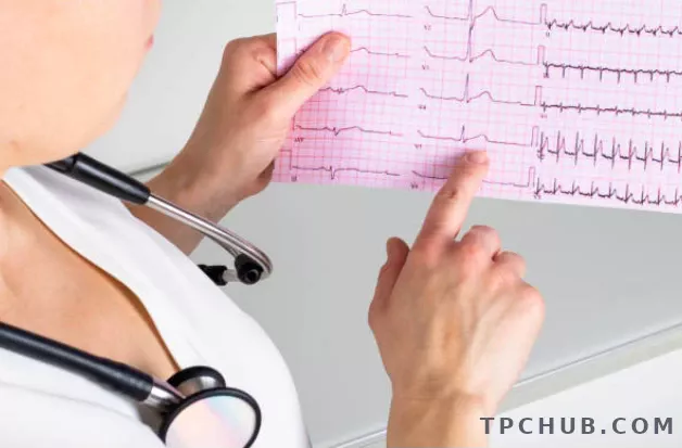 Acercamiento Al Estudio Holter Cardíaco